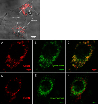 Nanoparticles uptake and localization